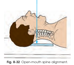 <p>Part position in the open-mouth AP projection</p>