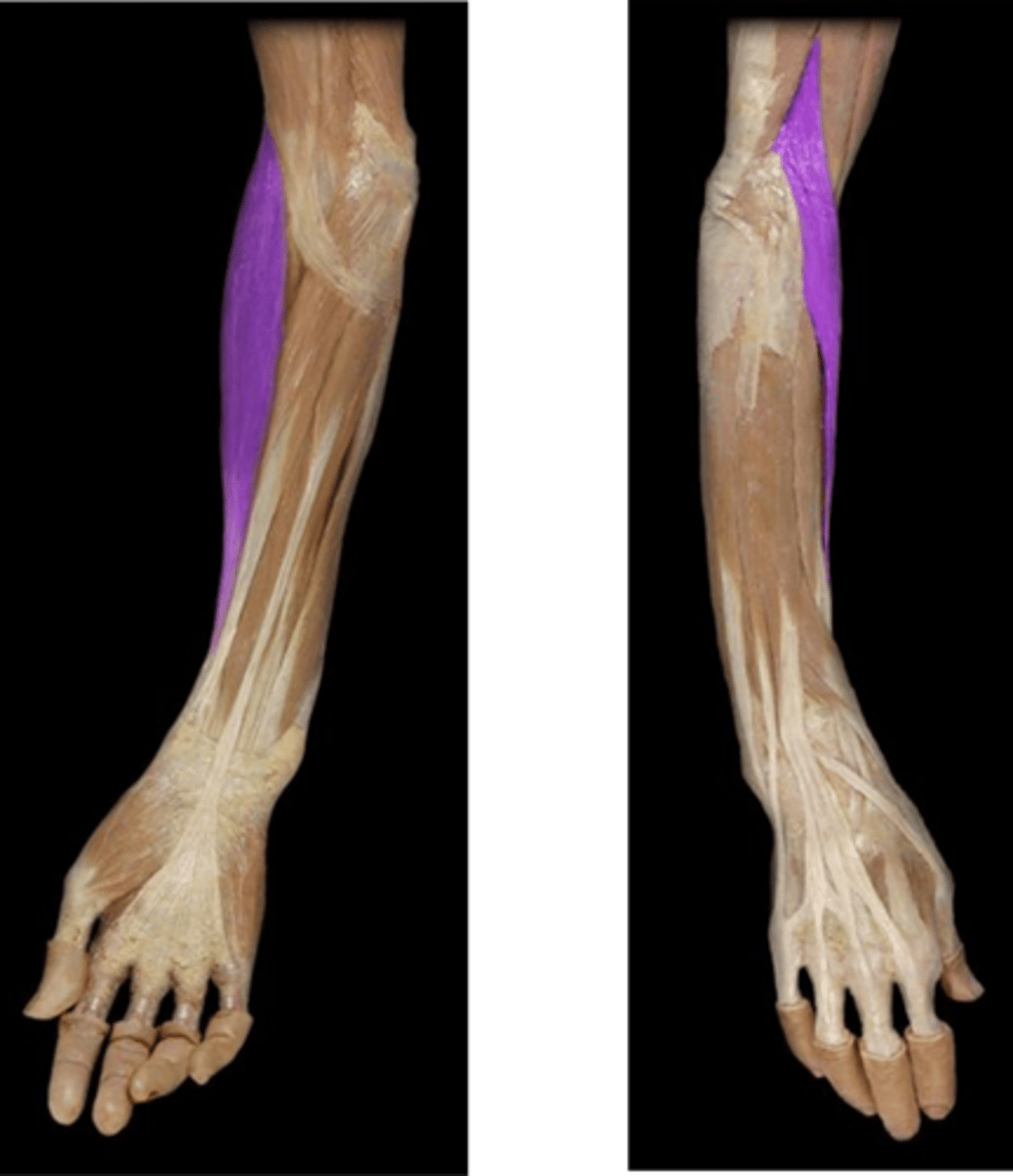 <p>What is the name of this muscle, highlighted in purple?</p>