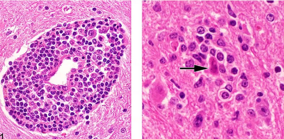 <p>Cattle, what is the etiology?</p><p>A-Bovine astrovirus</p><p>B-Bovine coronavirus</p><p>C-Bovine rotavirus</p><p>D-Bovine torovirus</p>