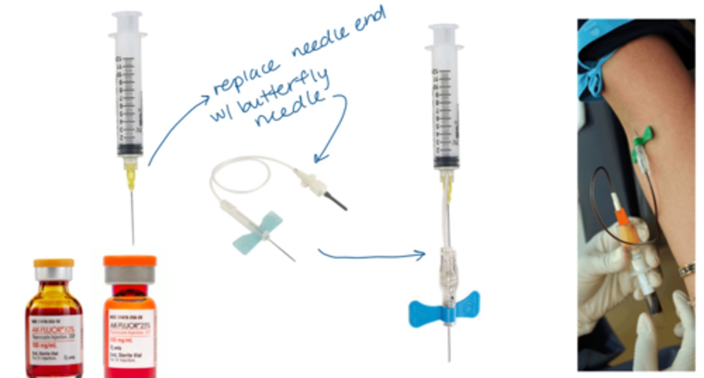 <p>anti-septic enviro</p><p>IV fluorescein (3mL of 25% NaFl or 5mL of 10% NaFl)</p><p>IM epinephrine in case of allergic rxn</p><p>diphenhydramine for itching</p>