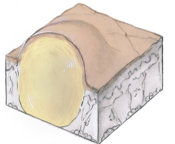 Nodule 