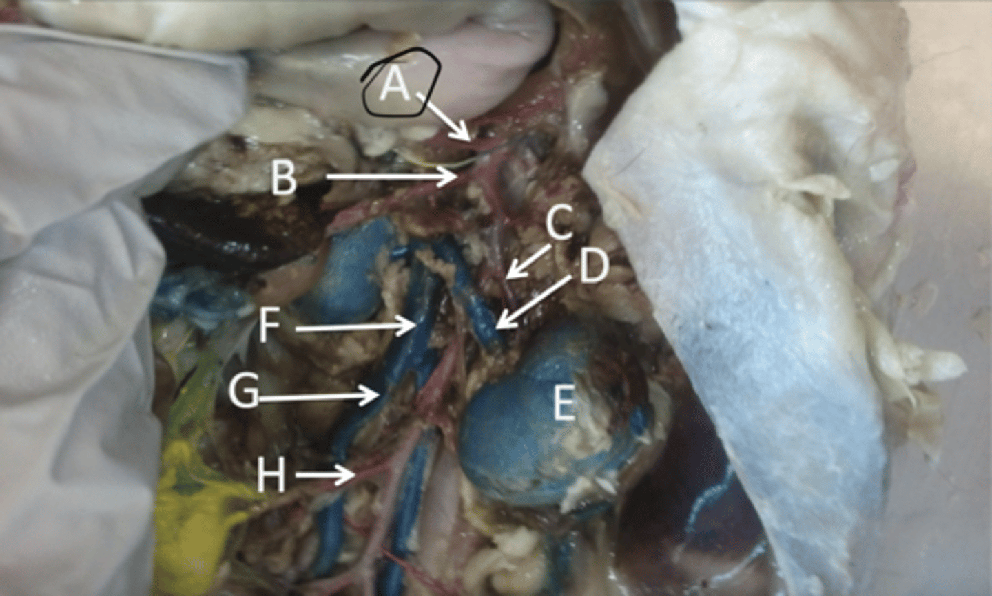 <p>first branch of the abdominal aorta, supplys stomach, pancreas gallbladder and spleen</p>