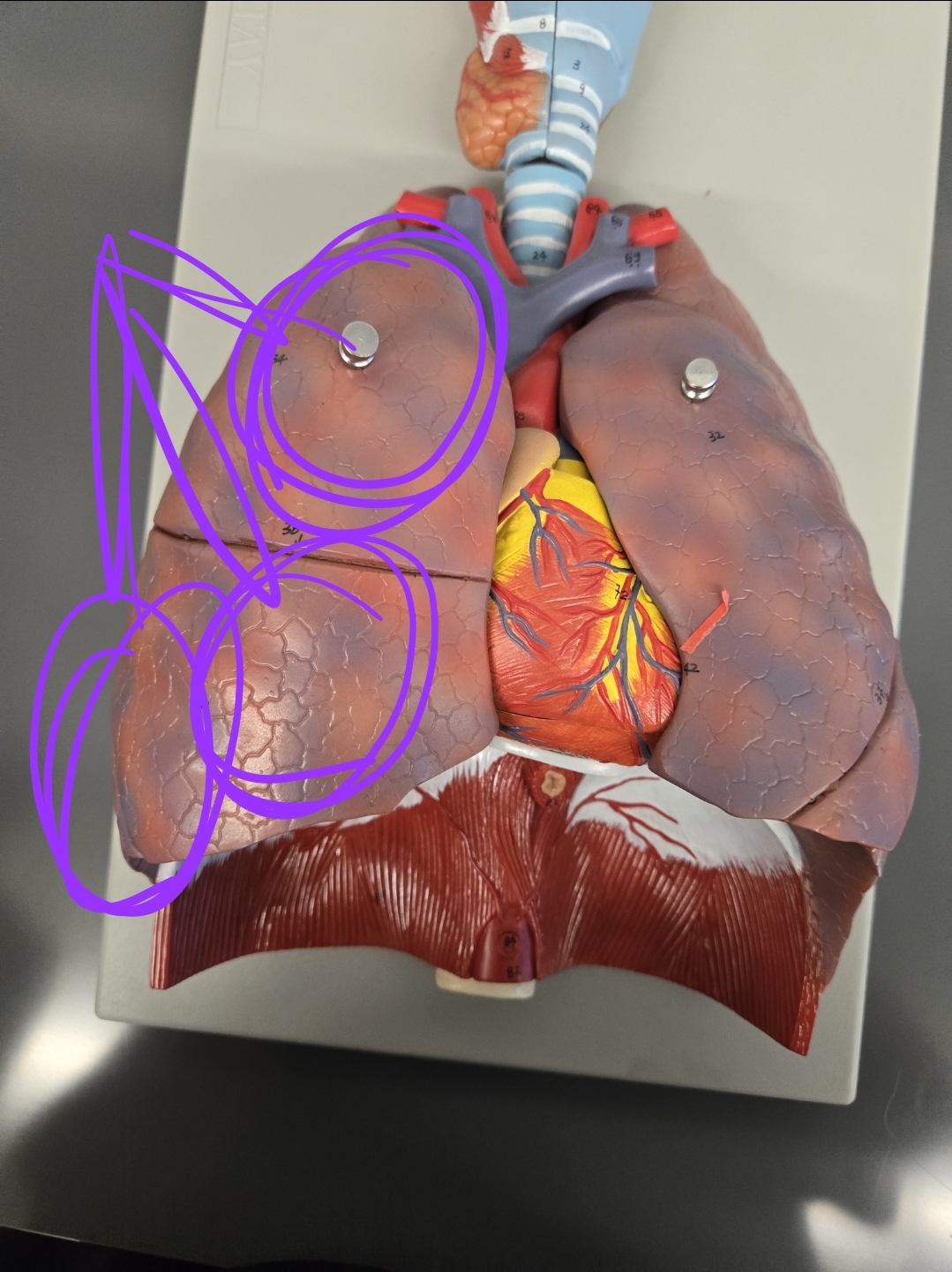 <p>Which side of the lung is this?</p>