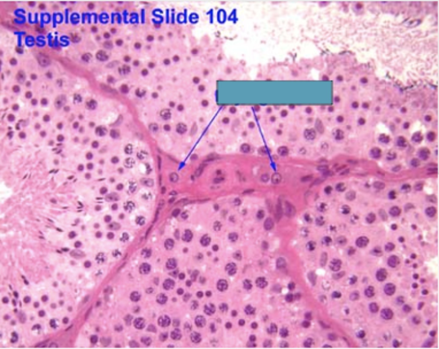<p>Identify the cells</p>