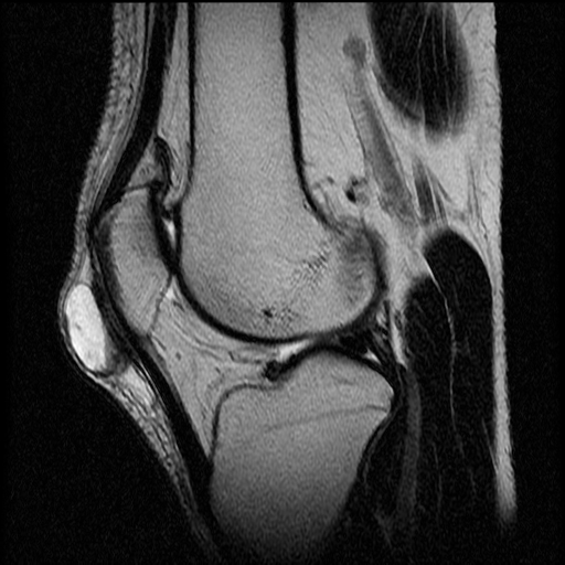 <p>(T2 MRI)</p>
