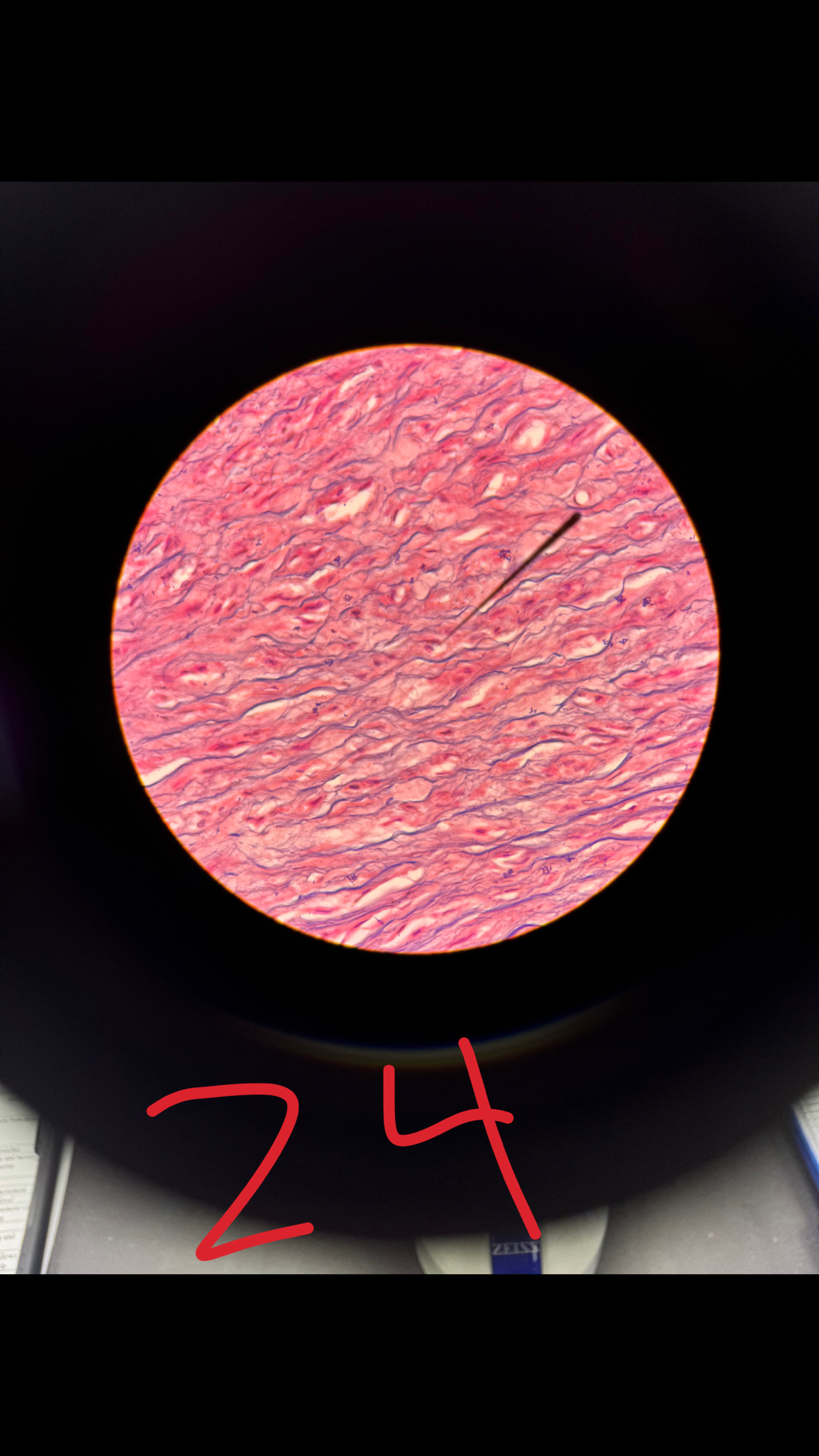 term image