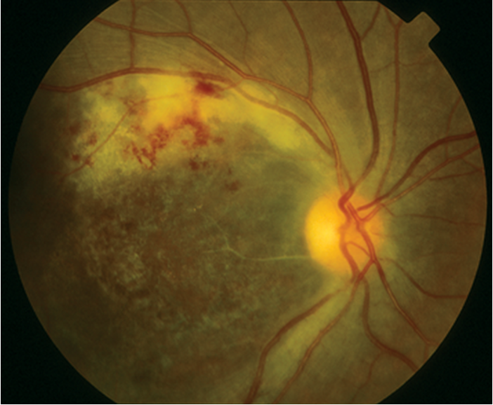 <p>(yellow white patches)</p>