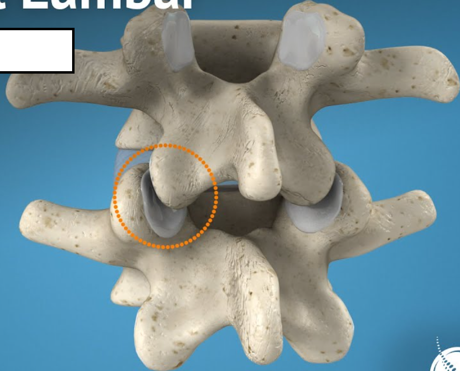 <p>Small, flat, smooth articular surface of a bone</p>