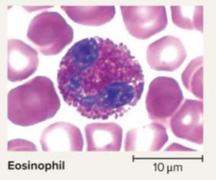 <p>Eosinophils</p>