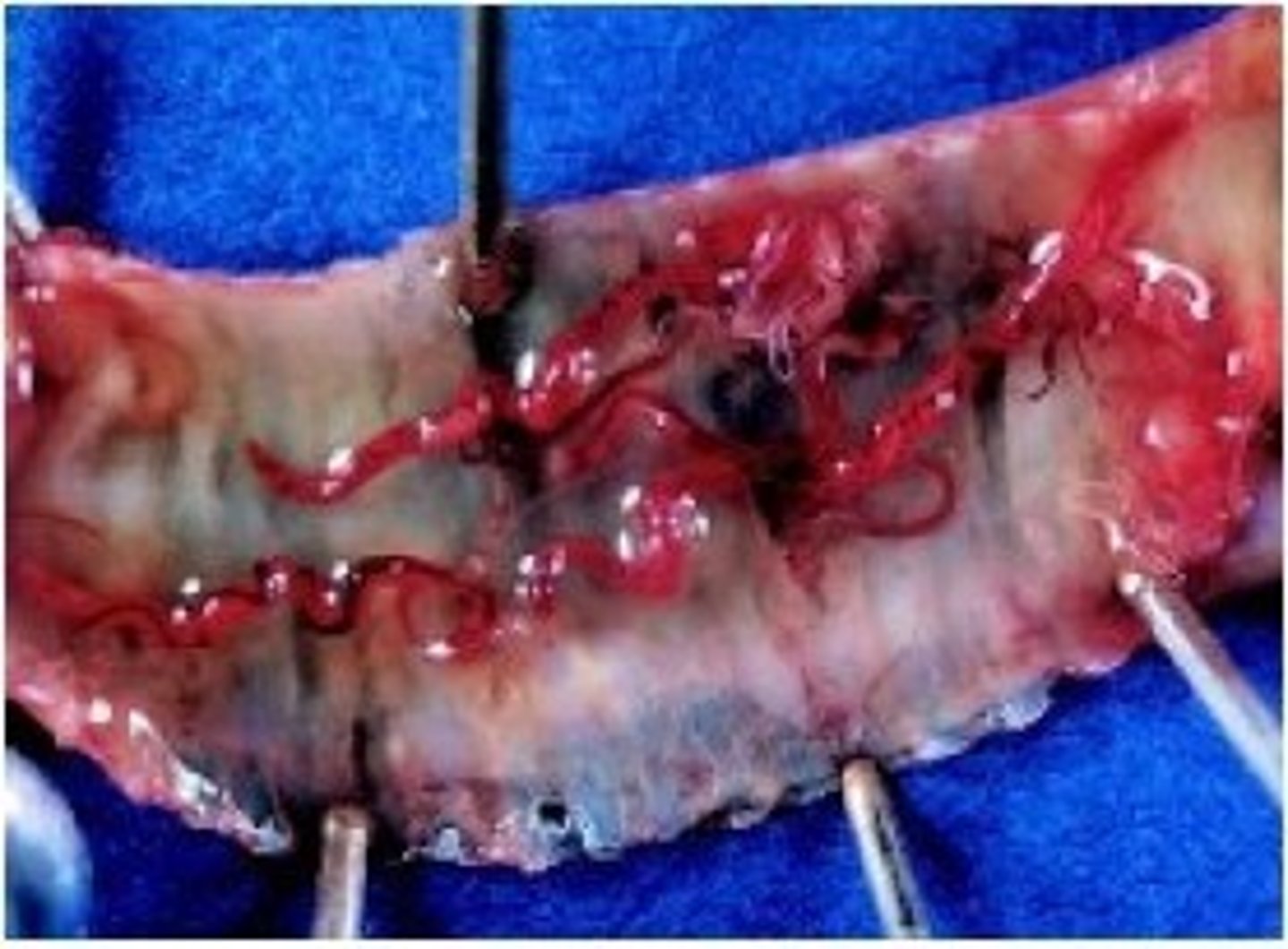 <p>What are these bright red worms found in the trachea of chicken that asphyxiated from excess mucous while exhibiting open mouth "gaping behavior" breathing?</p>