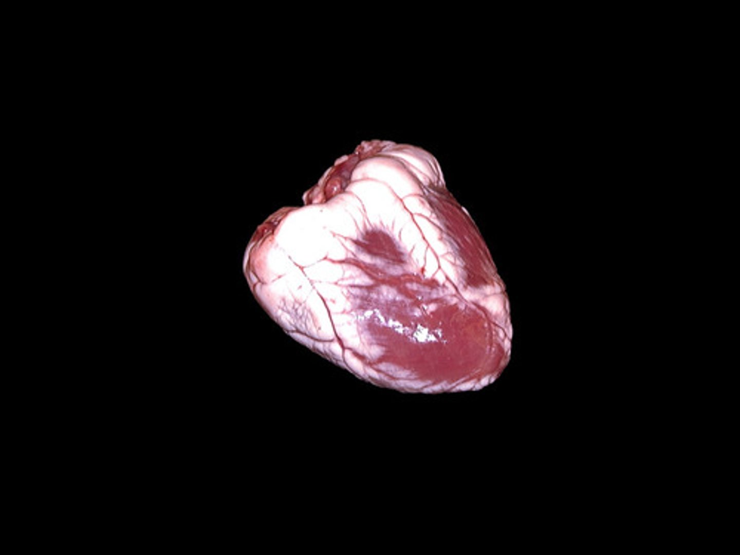 <p>-Multi-chambered, muscular organ that pumps blood throughout the body</p><p>-anchored and protected by pericardium (a sac of connective tissue)</p><p>-also a layer of fat</p><p>-wall consists of cardiac muscle cells and chambers/blood vessels are lined with endothelium</p><p>-lies in thoracic cavity (center of chest between lungs)</p>