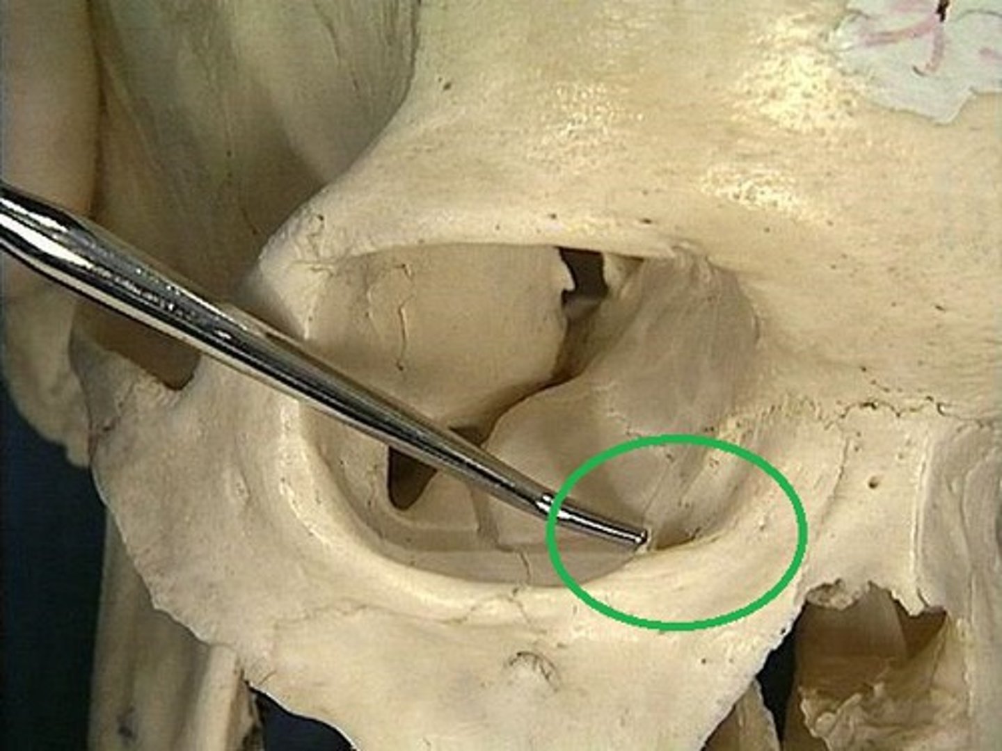 <p>empties lacrimal fluid into the nasal cavity</p>