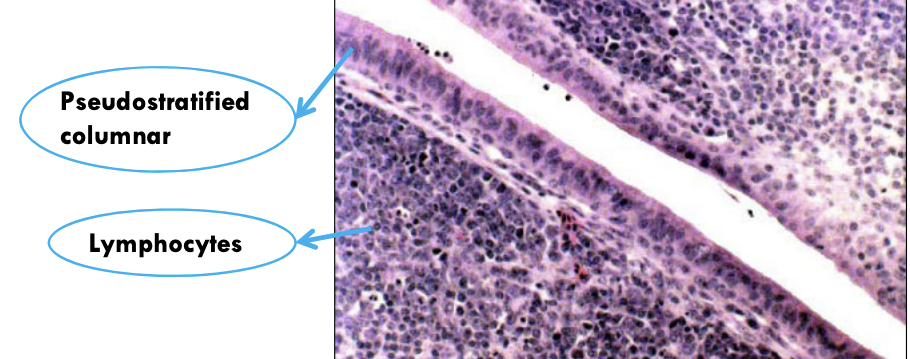<p><span style="color: red"><strong>Pseudostratified columnar epithelium </strong></span></p>