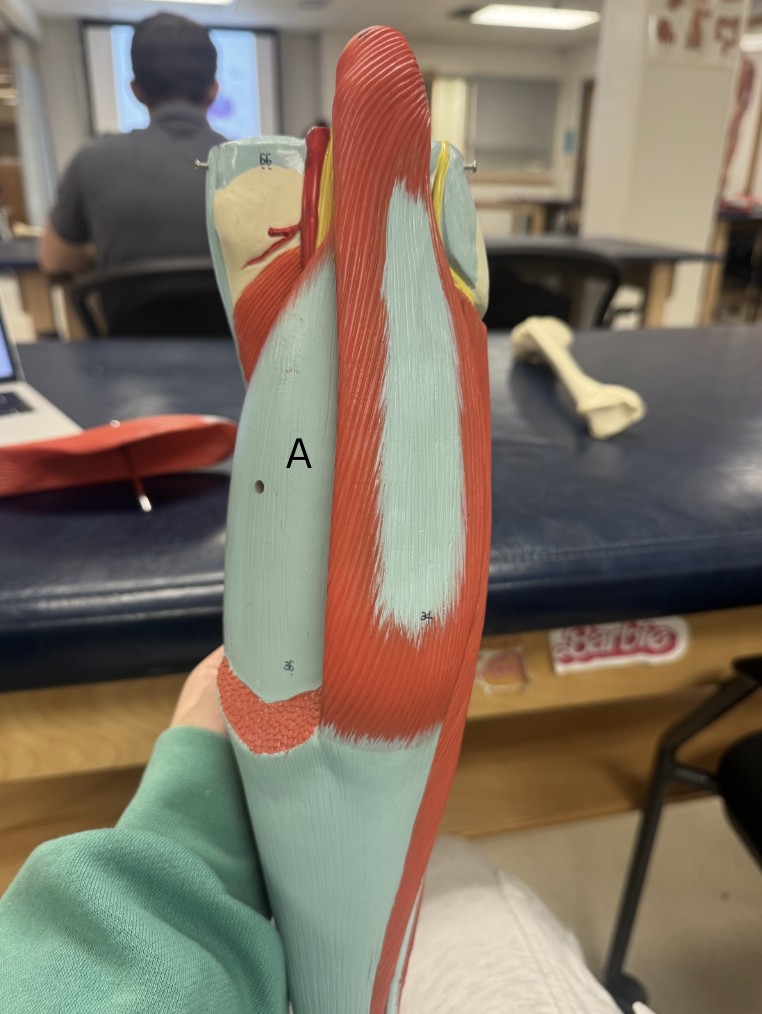 <p>Label the muscle A</p>