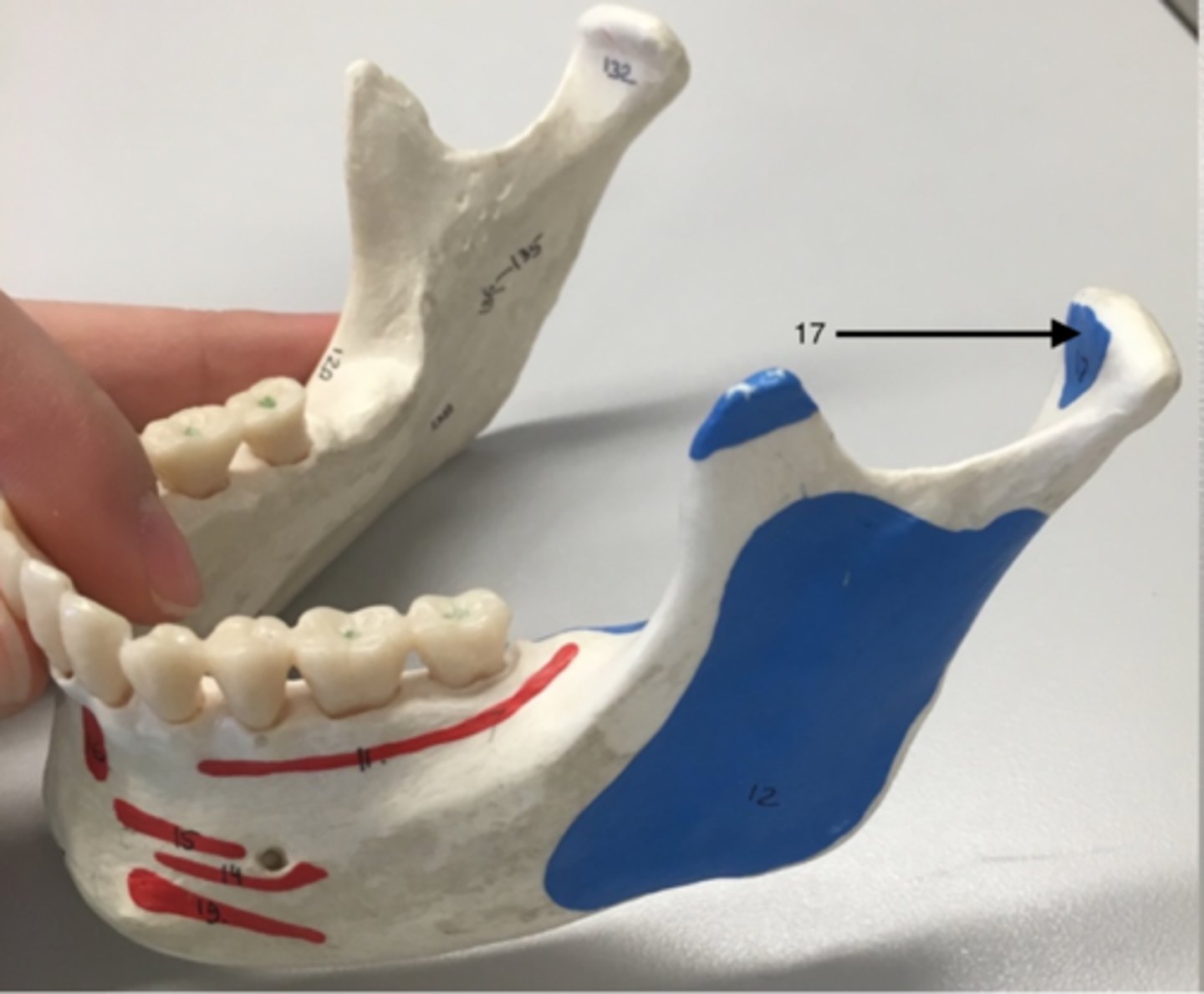 <p>17</p><p>I: Neck of mandible</p>