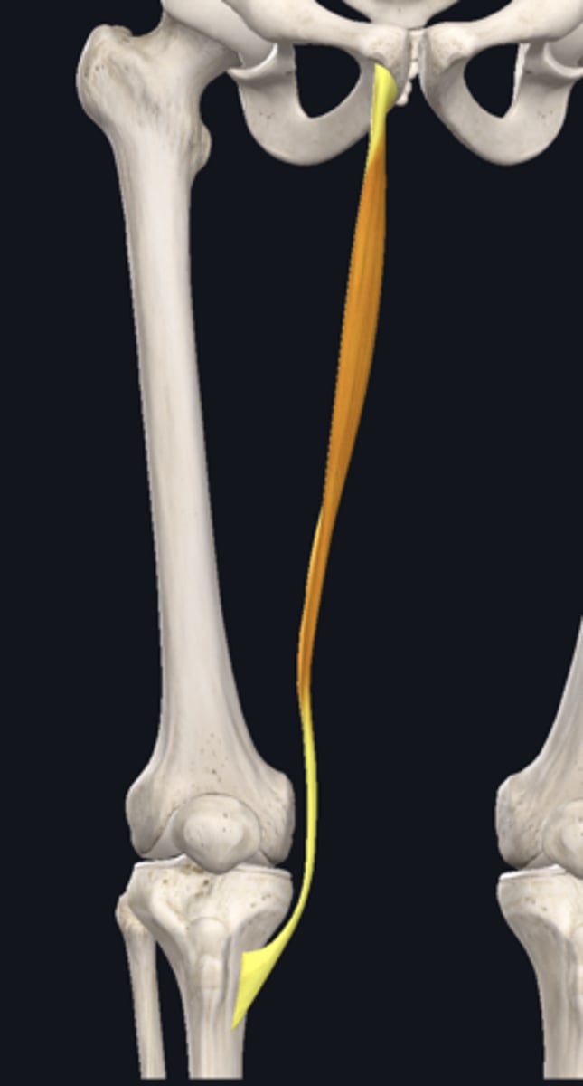 <p>Gracilis</p>