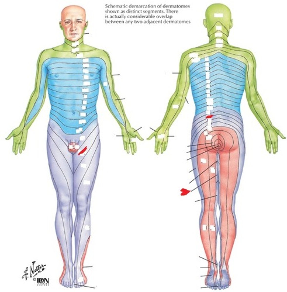 <p>Anterior thigh, 2-3 inches below ASIS</p>