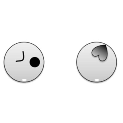 <p>What is the feral lie based on the anatomy showed?</p>