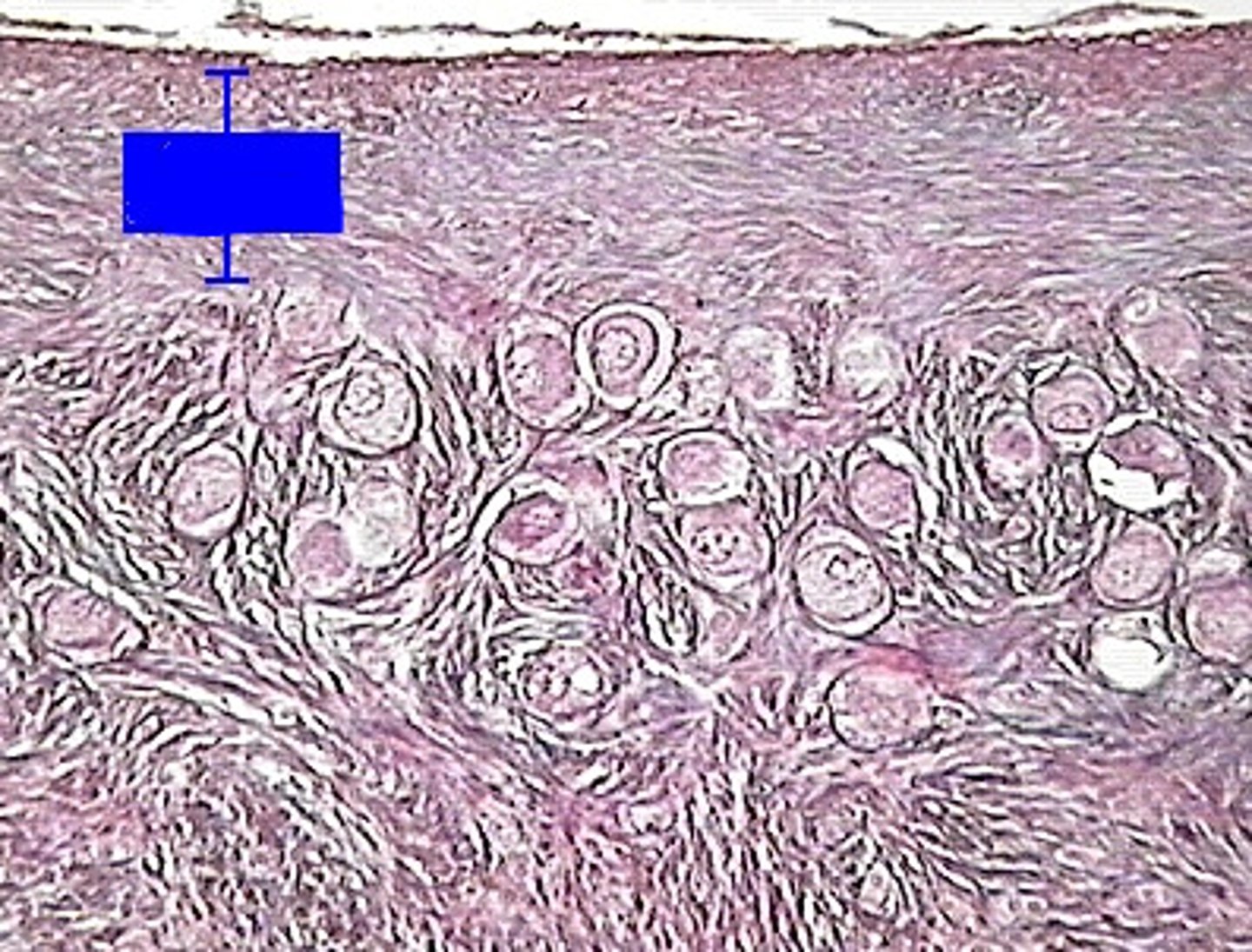 <p>a layer of wavy connective tissue beneath the germinal epithelium</p>