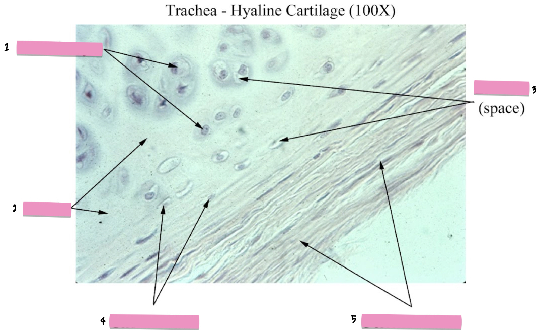 <p>(1) Hyaline cartilage cellular characeteristics</p>