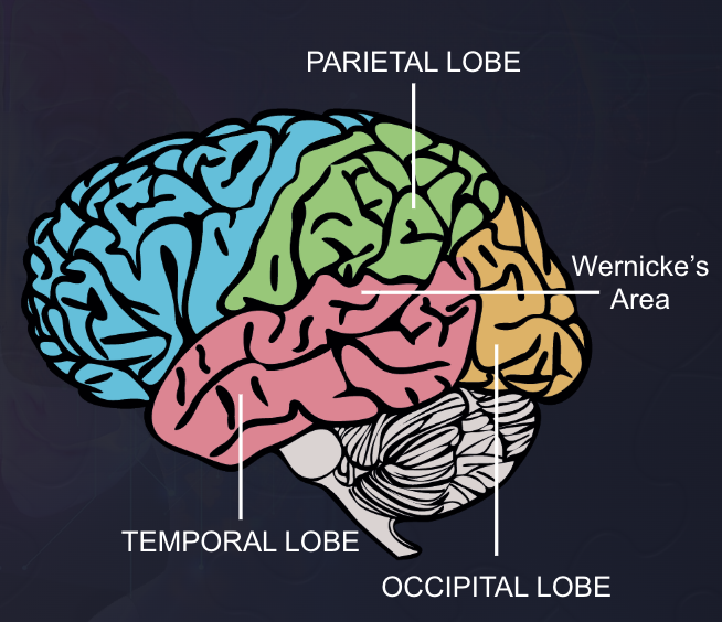 <p>Wernicke’s Aphasia (ability to produce speech but not understand language). </p>