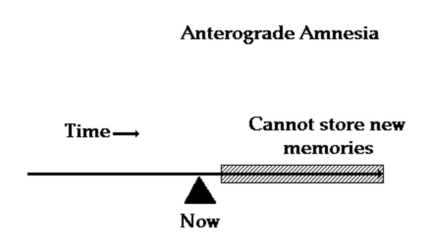 <p>(C) don't, do</p><p>Individuals with Anterograde Amnesia cannot remember events moving forward. For this reason, these individuals would forget the faces. The amazing thing is that the Mere Exposure Effect is still exhibited by these individuals, which is why they favor the faces that they were exposed to before.</p>