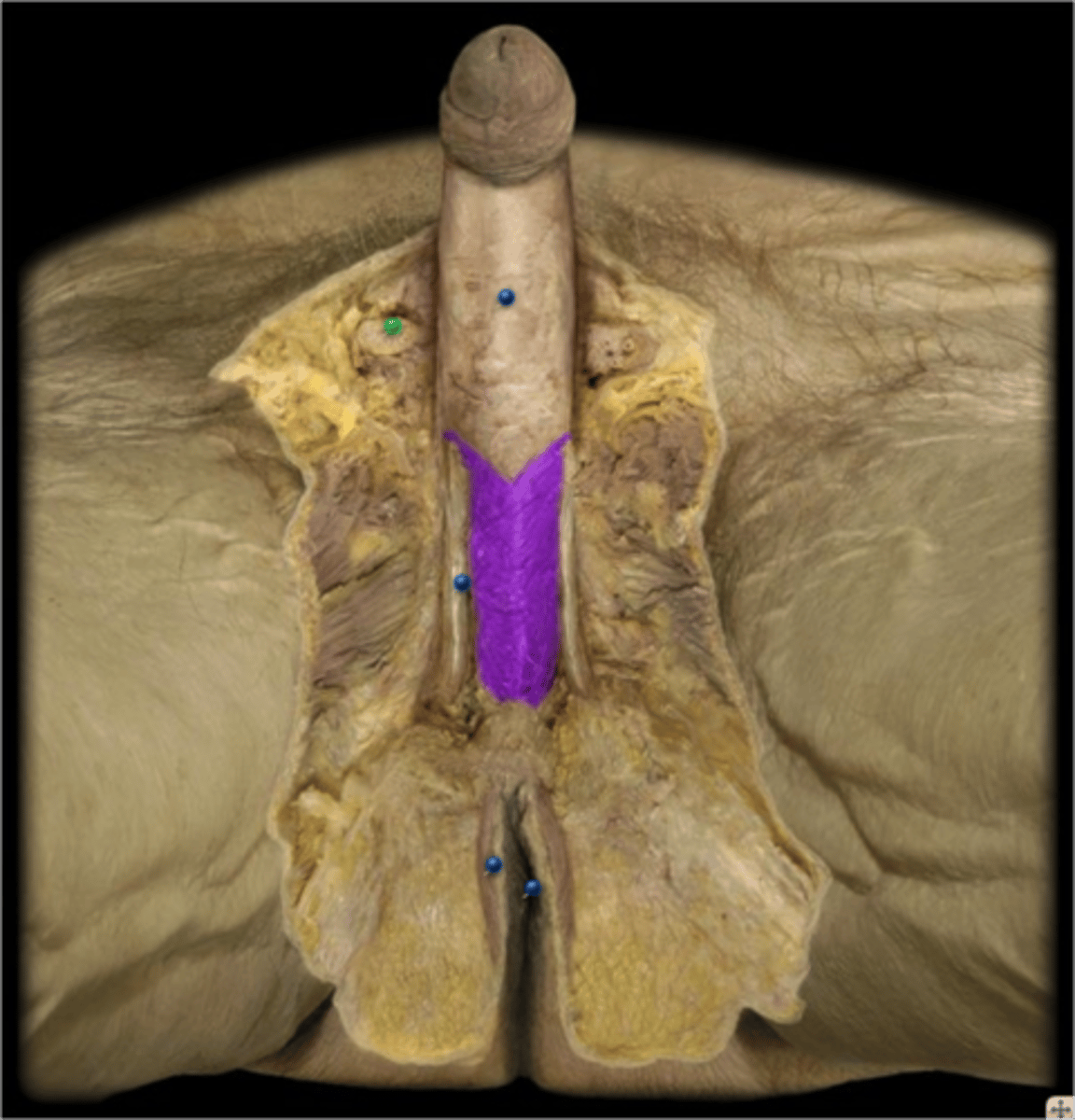 <p>MUSCLE</p>