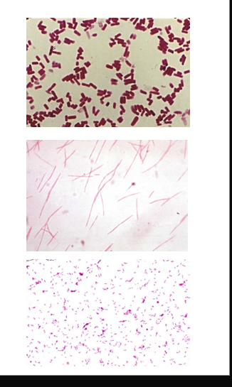 <ul><li><p>large GPB box car shape</p><ul><li><p><em>Clostridium perfringens </em></p></li></ul></li><li><p>Thin GNB with tapered ends</p><ul><li><p><em>Fusobacterium nucleatum</em></p></li></ul></li><li><p>Pleomorphic palely stained GNB</p><ul><li><p><em>Bacteroides</em> </p></li></ul></li></ul><p></p>