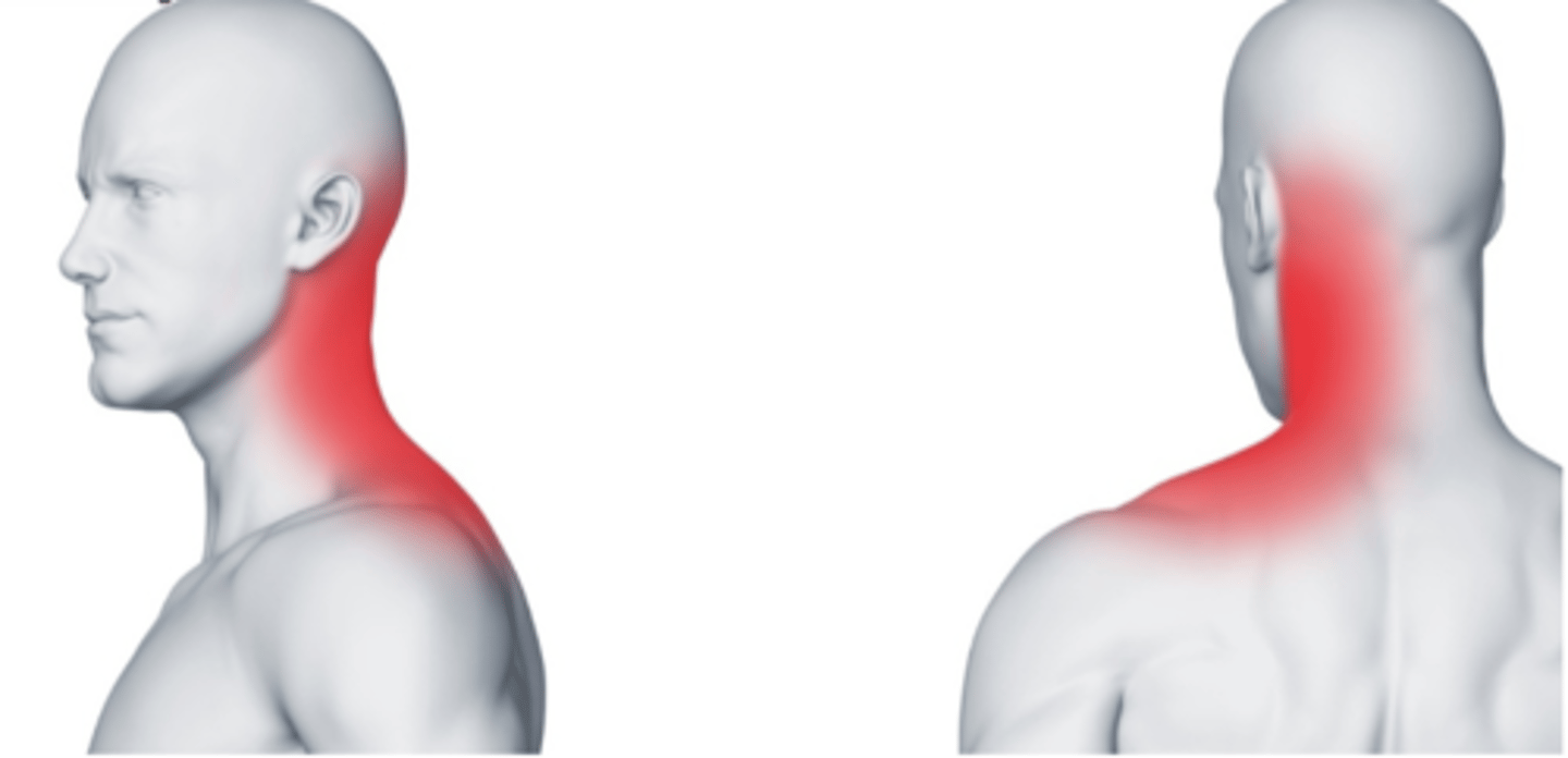 <p>location of numbness</p>