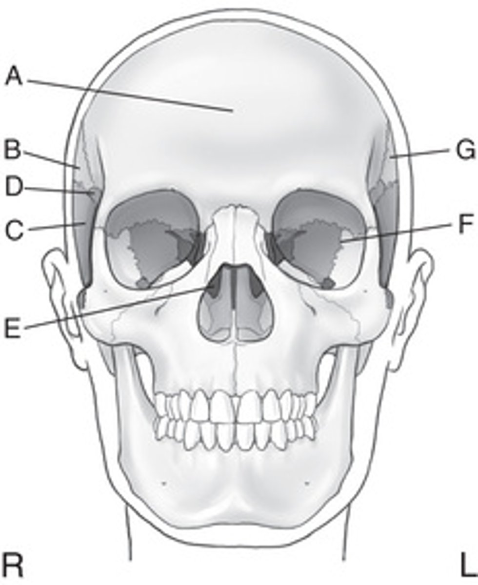 <p>A. Frontal</p><p>B. Right parietal</p><p>C. Right temporal</p><p>D. Sphenoid</p><p>E. Ethmoid</p><p>F. Left temporal</p><p>G. Left parietal</p><p>H. Occipital</p>
