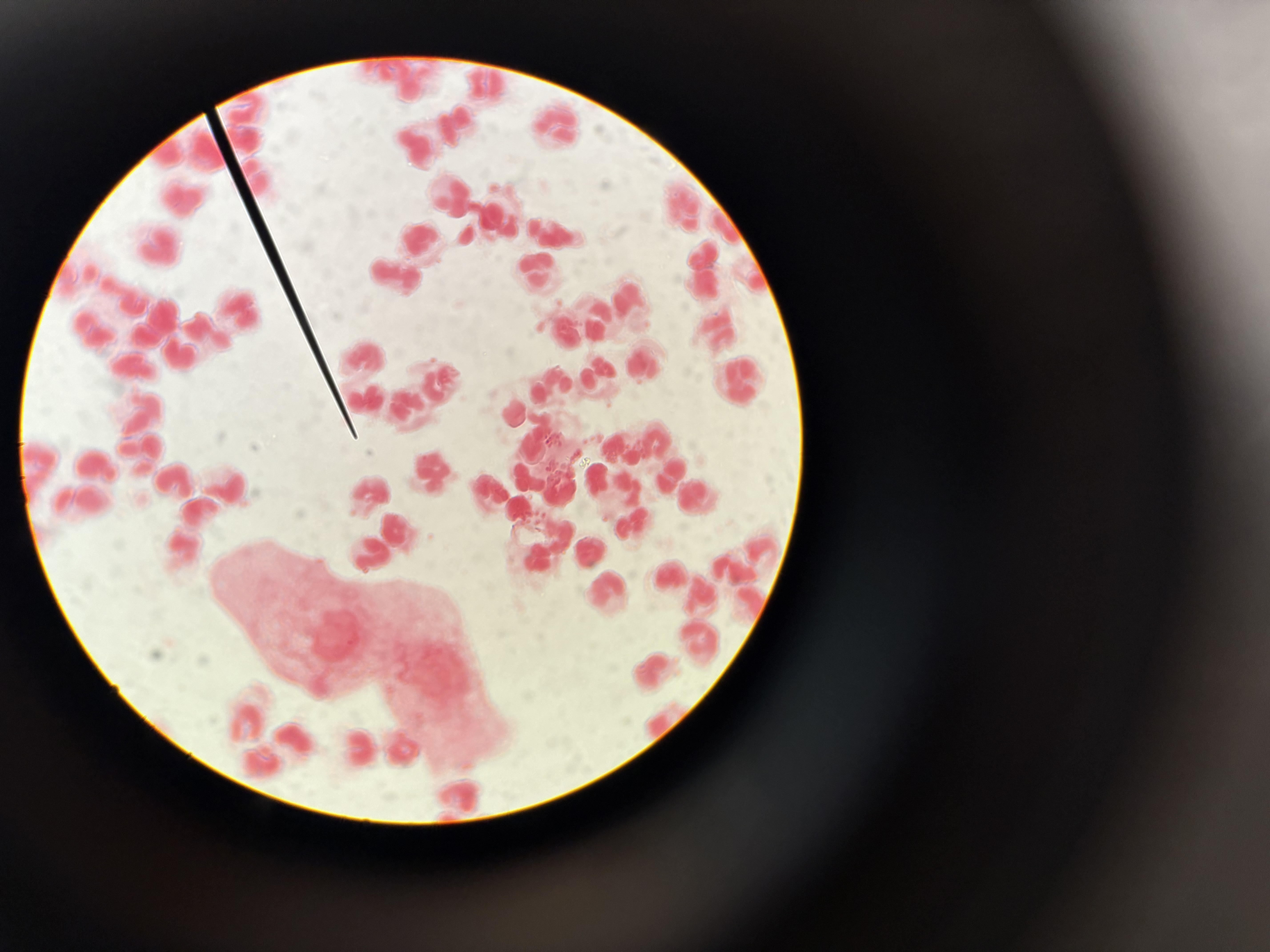 <p>GC smear (positive)</p>