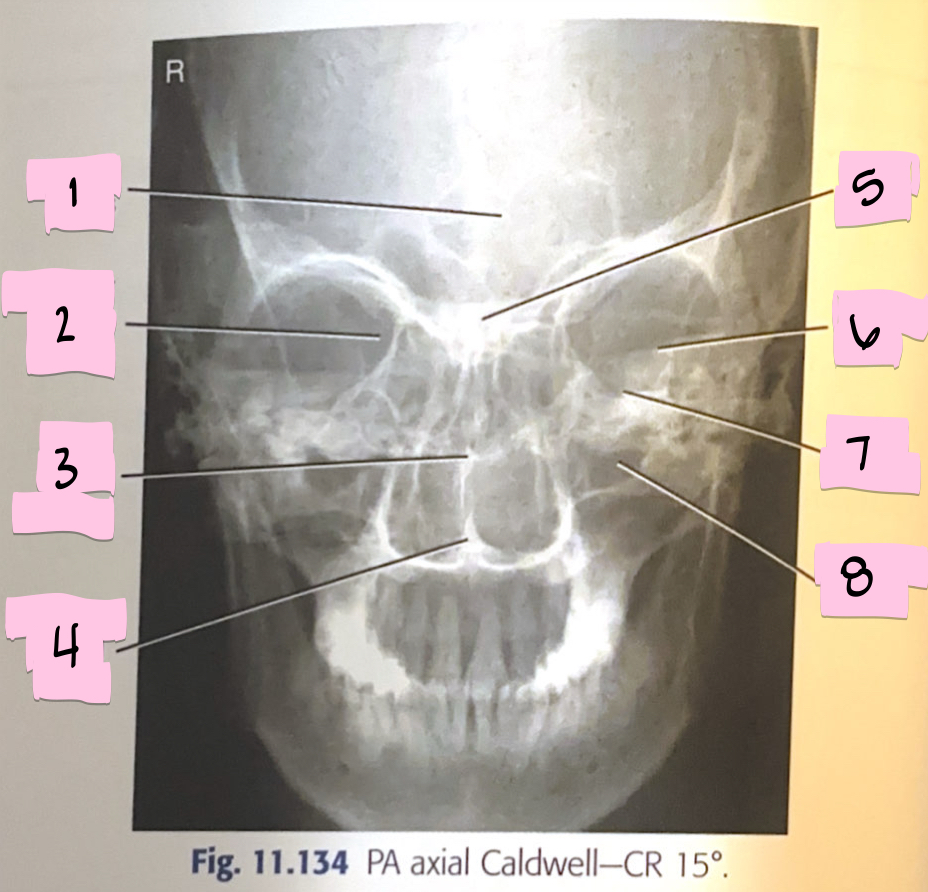 <p>What is 3 pointing to?</p>