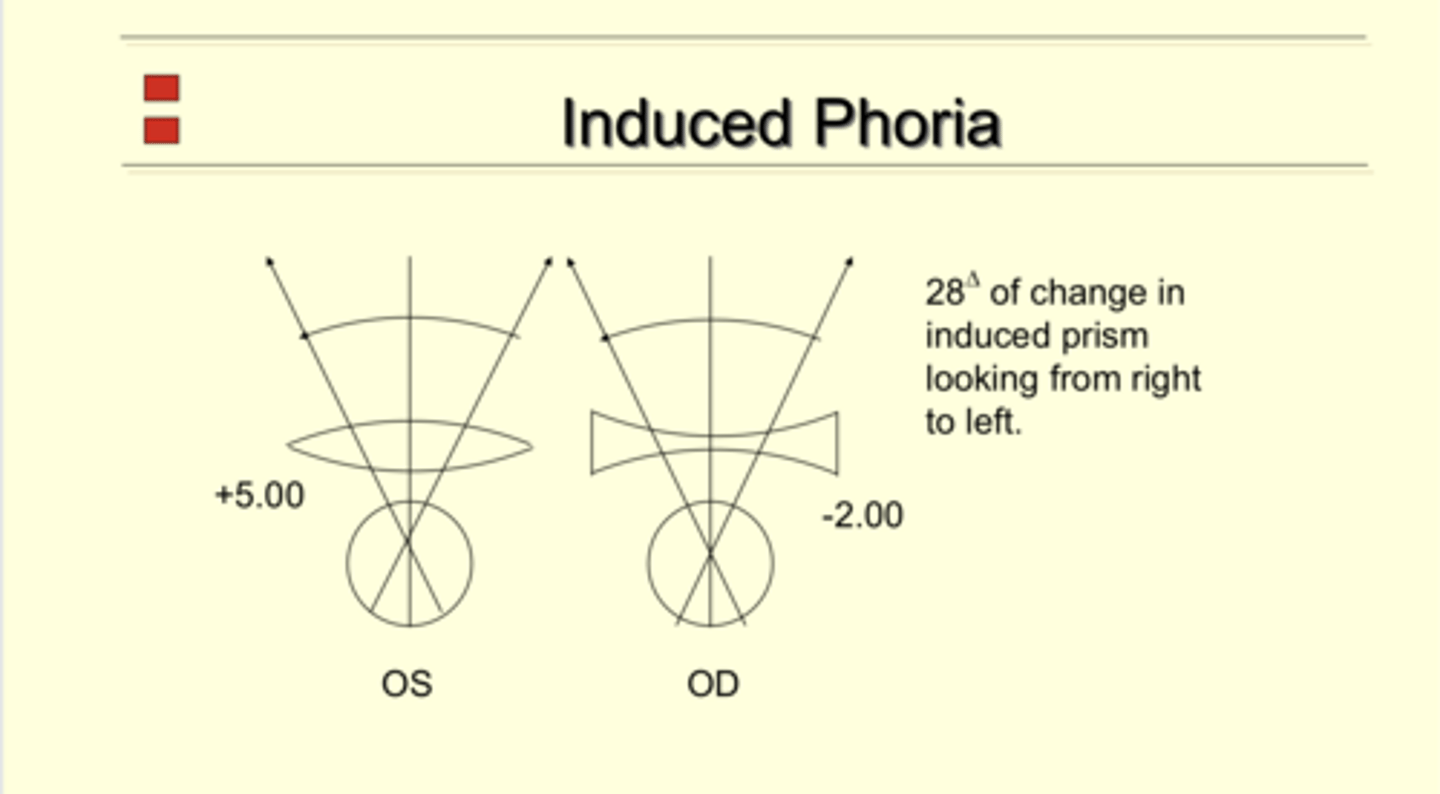 <p>OD: -2.00</p><p>OS: +5.00</p><p>A patient is viewing 20mm to the left of optical center. What is the induced phoria of each eye?</p>