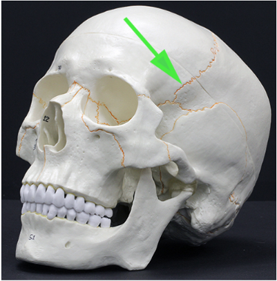 <p>What suture is marked by the green arrow?</p>