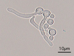 <p>What species of yeast is germ tube +?</p>