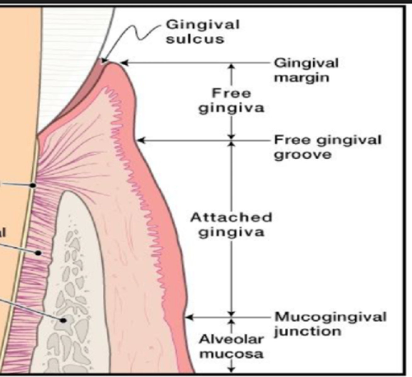 <p>collar gingiva that surrounds tooth</p><p>-not attached to bone, creates pocket measured w/ probe</p><p>-healthy: 1-3 mm pocket</p>