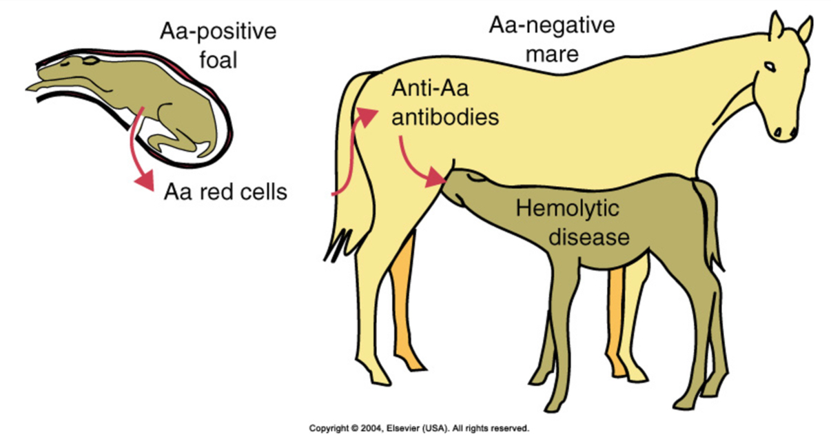 <p><span><span>•Mare is exposed to a RBC antigen of fetus that she does not have and produces antibody (types Aa and Qa)</span></span></p><p><span><span>•Subsequent pregnancy, a foal with that blood type (inherited from sire)</span></span></p><p><span><span>•Ingestion of colostrum containing antibody to foal RBCs</span></span></p><p><span><span>•Lysis or phagocytosis of foal RBCs</span></span></p><p></p><p><span><span>If mare lacks Aa and Qa antigens and the sire has them these are the ones that seem to induce the best immunologic response in the mare. She will produce a lot of antibody to these antigens.&nbsp; The first pregnancy is not usually a problem. The later pregnancies is when the problems occur. The exposure can occur due to a tear in placenta, at birth when there is a tear and exposure of the mother to fetal cells, or transfusion.</span></span></p><p></p>