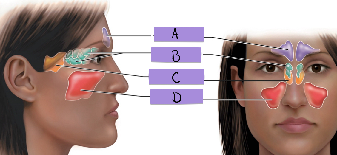 <p>maxillary sinus</p>