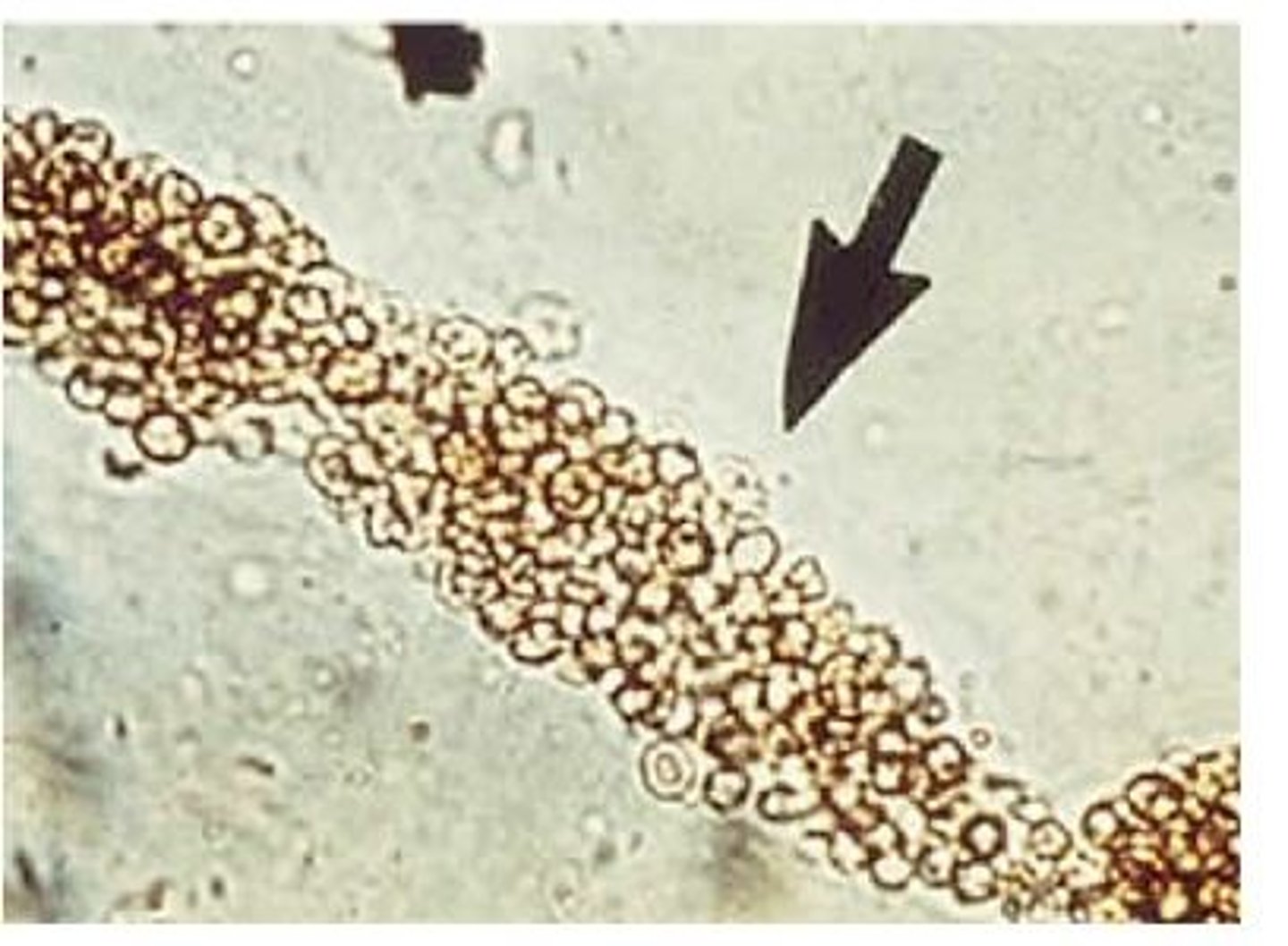 <p>- what other cells are present around the cast?</p>