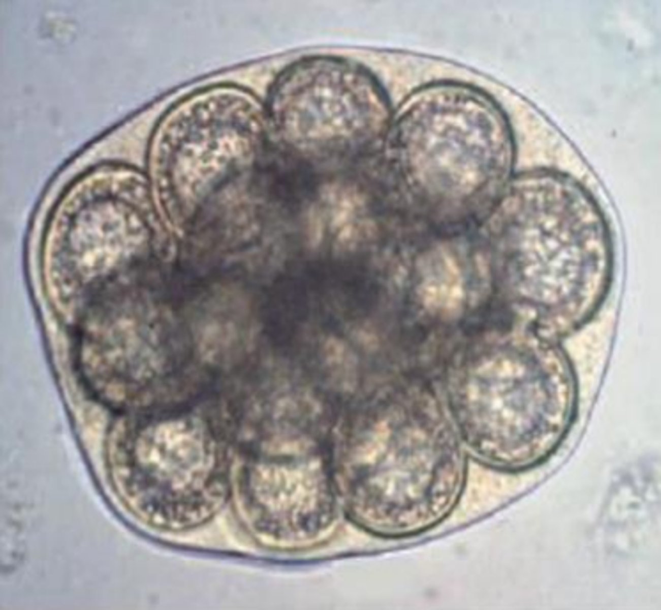<p><span>This was found in the stool sample of a dog with no associated clinical signs.&nbsp; What is it?</span></p>