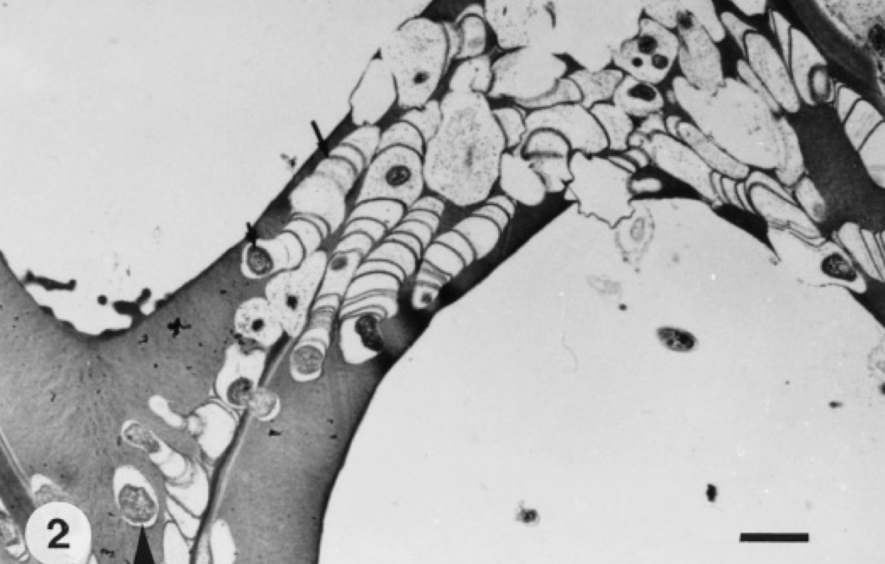 <p>Tunneling bacteria</p>