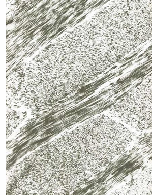 <p>-crystallites 200×40×40nm</p><p>-pores 2-10nm</p><p>-laminar pores in high caries risk group</p><p>-cylindrical pores in low caries risk group</p>