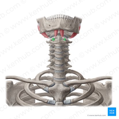 <p>What muscle is this?</p>