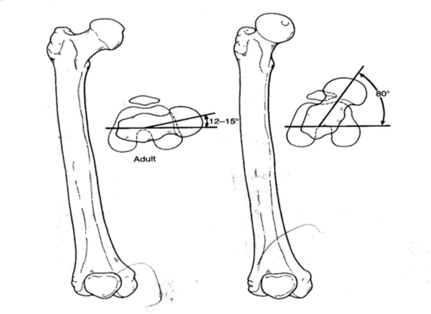 <p>angle between the axis of the femoral condyles and the axis of the head/neck of the femur in the transverse plane</p>