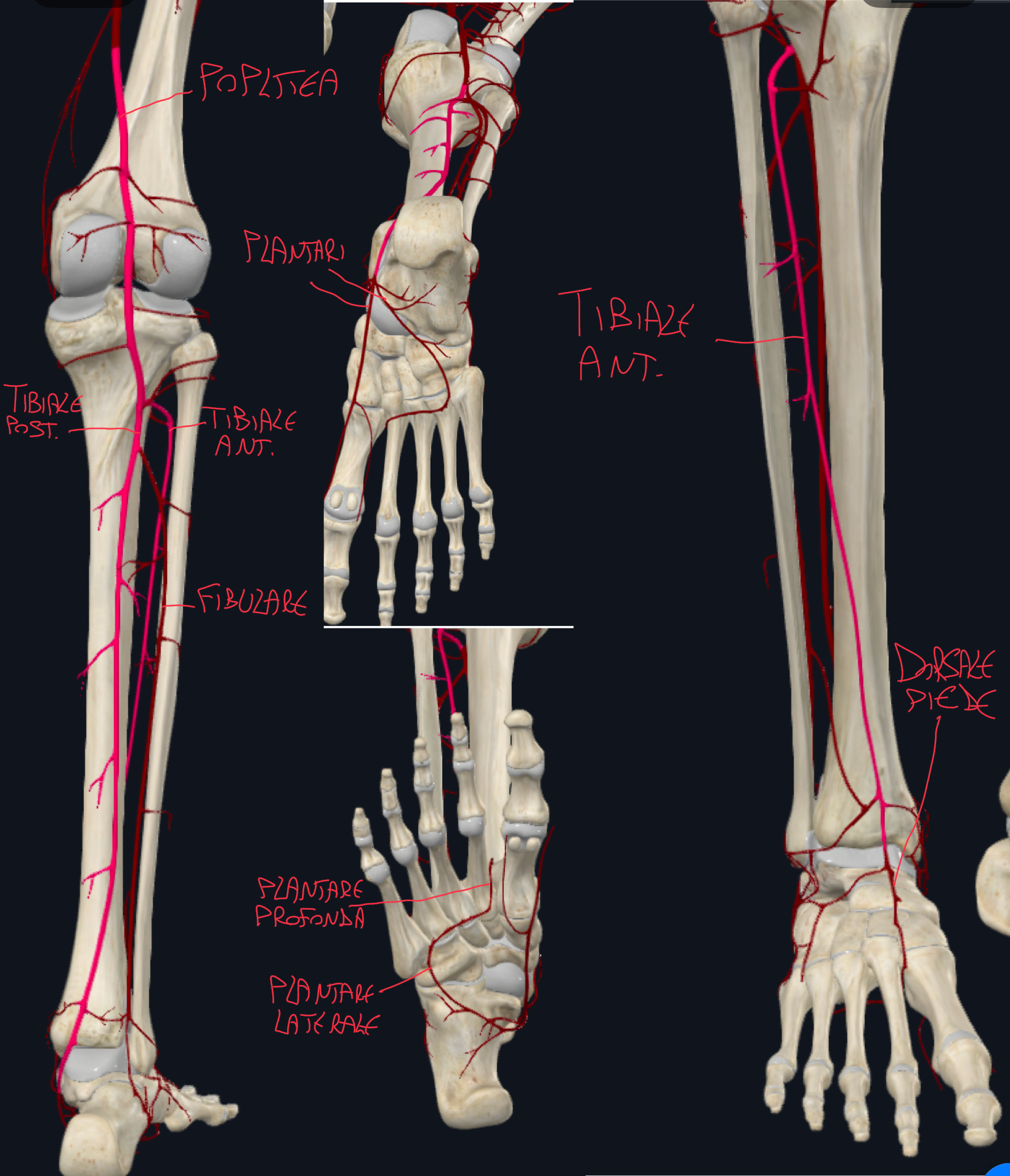 <p>Al margine inferiore del muscolo popliteo (che corrisponde al margine superiore dell’arcata tendinea del soleo) di divide in:</p><ul><li><p>Arteria Tibiale Anteriore e Posteriore</p></li></ul><p>ARTERIA TIBIALE POSTERIORE:</p><ul><li><p>Decorre nel compartimento posteriore della gamba vascolarizzandola e invia l’ARTERIA FIBULARE</p></li><li><p>Poi attraversa il tunnel tarsale dietro il malleolo mediale e si divide in ARTERIA PLANTARE MEDIALE E LATERALE</p></li></ul><p>ARTERIA TIBIALE ANTERIORE:</p><ul><li><p>Decorre nel compartimento anteriore della gamba vascolarizzandola e raggiunge il piede come ARTERIA DORSALE DEL PIEDE che tra i capi del primo muscolo interosseo dorsale diventa ARTERIA PLANTARE PROFONDA che si anastomizza con l’arteria plantare laterale</p></li><li><p>Il polso dell’arteria dorsale del piede è importante per valutazione della perfusione periferica</p></li></ul><p>N.B. il compartimento laterale della gamba è vascolarizzata da rami del fibulare e tibiale anteriore</p><p></p>