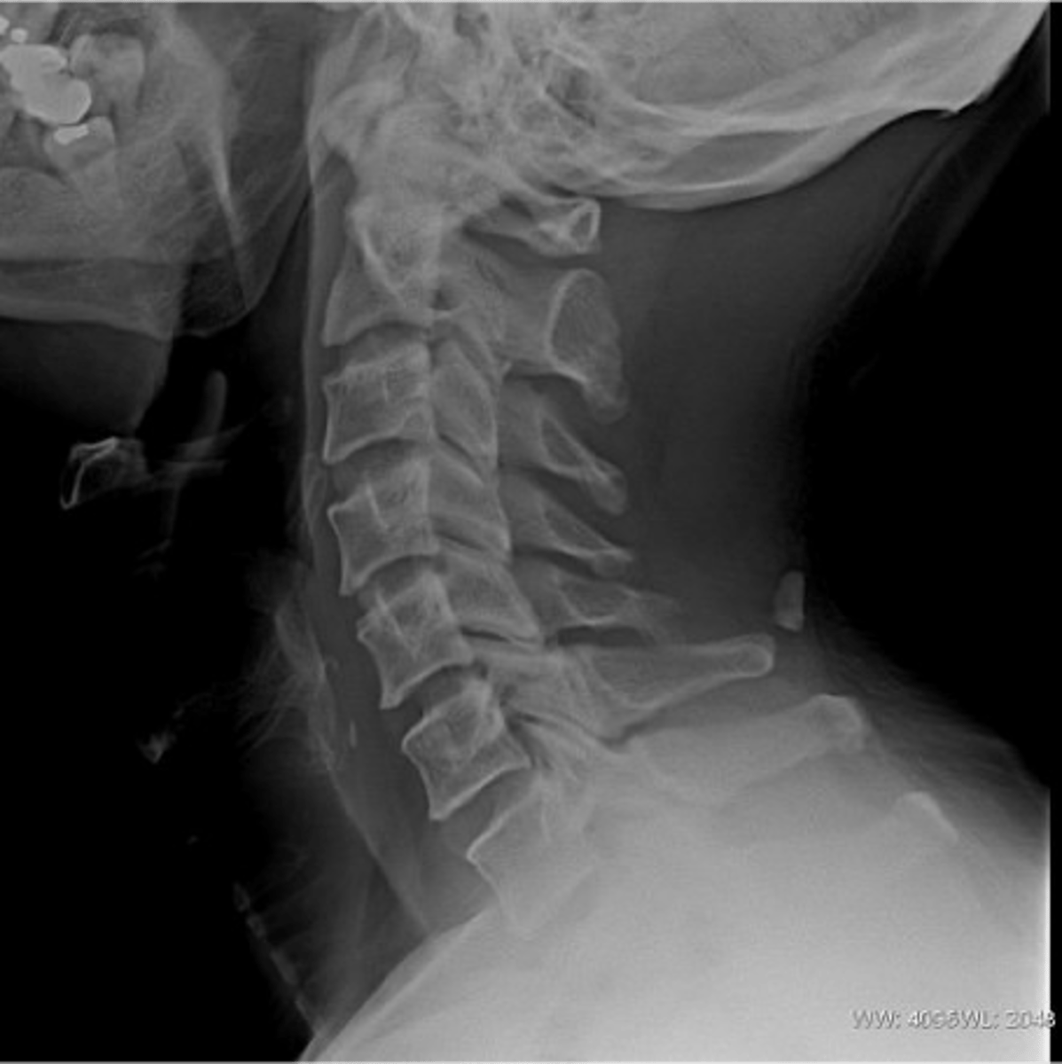 <p>Can you adjust this patient?</p>