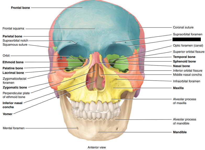 <p>State and identify which part of the cranial bone is being censored.</p>