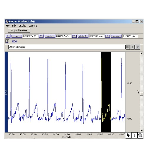 <p><span>The highlighted period of time is an Q-T ____.</span><br><span>Its value is _____.&nbsp;</span></p>