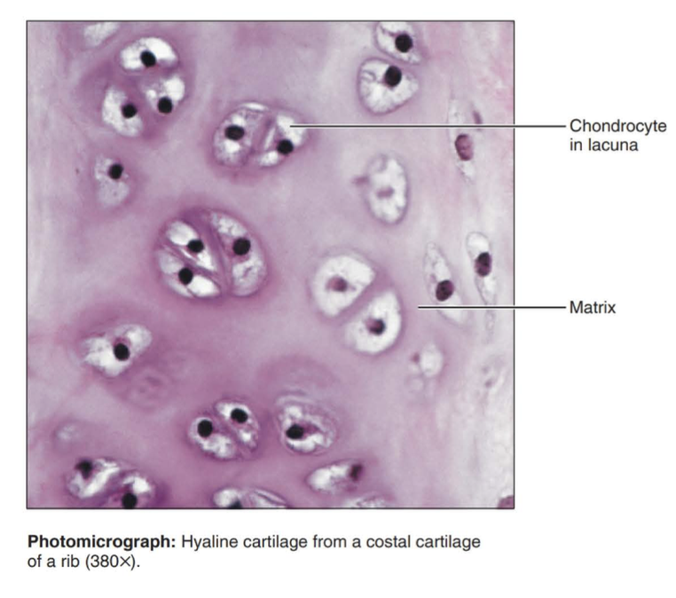 <p>Amorphous but firm matrix; collagen fibers form an imperceptible network; chondroblasts produce the matrix and when mature (chondrocytes) lie in lacunae</p>