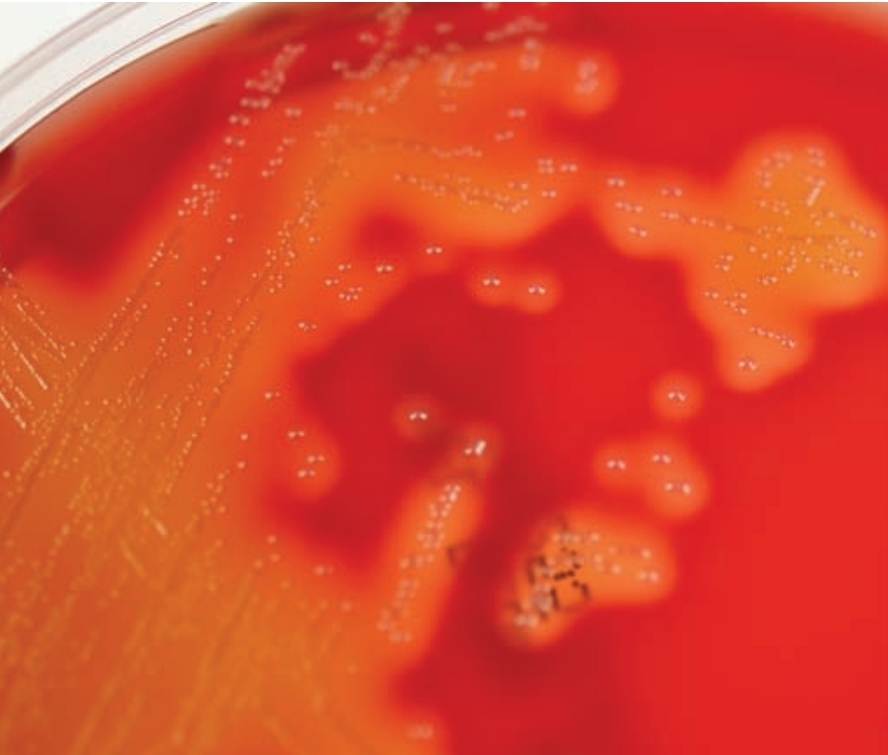 <p>White colonies sorrounded by diffuse zone of b-hemolysis</p>